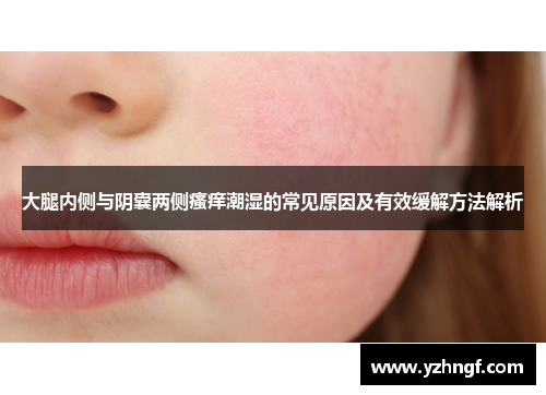 大腿内侧与阴囊两侧瘙痒潮湿的常见原因及有效缓解方法解析
